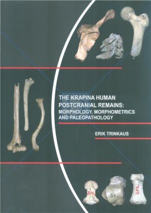 The Krapina human postcranial remains